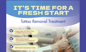 Tattoo Removal Treatment thumbnail
